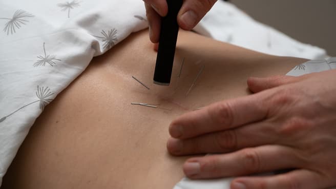 Bild Nicole Signer - Praxis für Akupunktur & Tuina