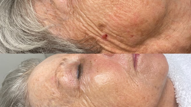 Bild Maison du Laser