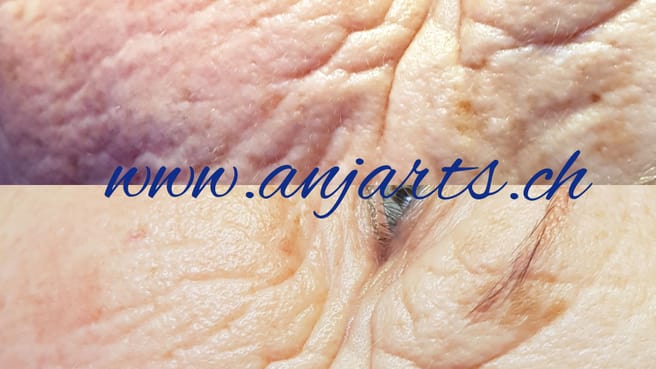 Cosmetic Anjarts image