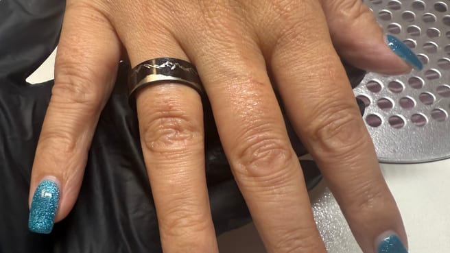 Händ und Füess Morgante image