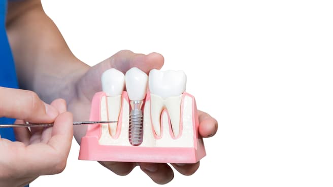 TEAM 15 - PRAXIS FÜR ZAHNMEDIZIN & KOMPETENZZENTRUM FÜR IMPLANTOLOGIE image