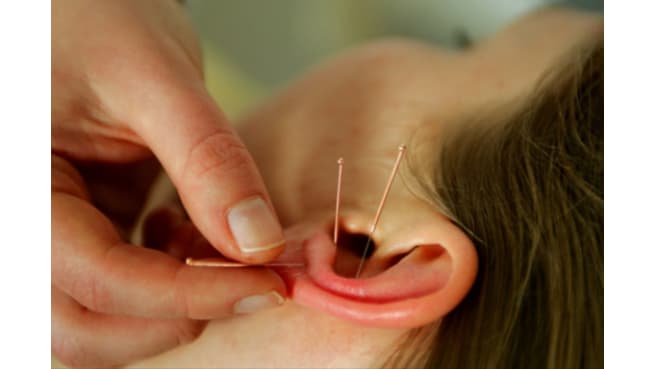 Immagine Praxis für Akupunktur und Tuina