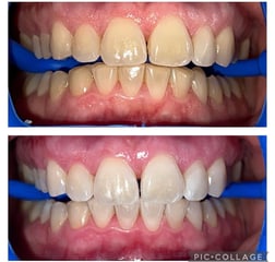 Immagine Dentalhygiene&Bleaching