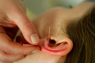 Bild Praxis für Akupunktur und Tuina
