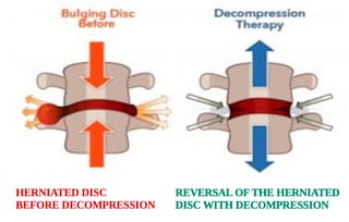 Bild Ostéopathie Lachat Doniphane - RING DINGER® TECHNIQUE - Centre Suisse & Européen de décompression neuro-vertébrale manuelle